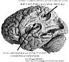 Arcuate fasciculus